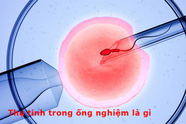 thụ tinh trong ống nghiệm